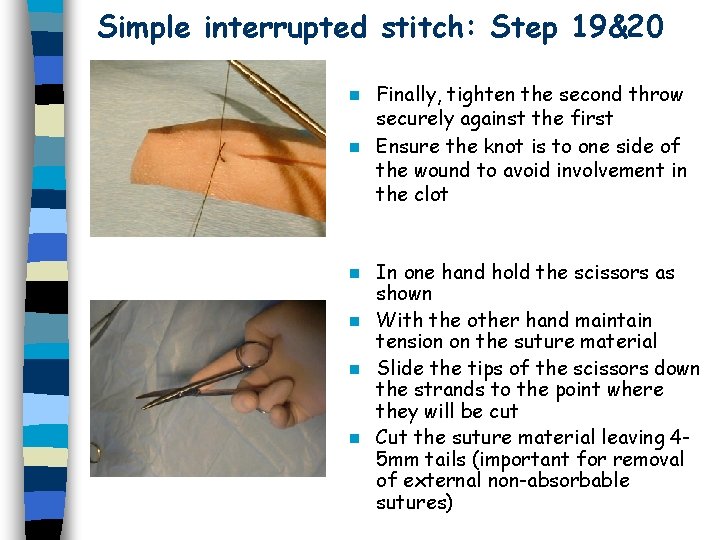 Simple interrupted stitch: Step 19&20 Finally, tighten the second throw securely against the first