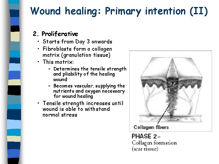 Wound healing: Primary intention (II) 2. Proliferative • Starts from Day 3 onwards •