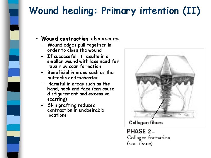 Basic surgical skills Wound Healing and Surgical Instruments