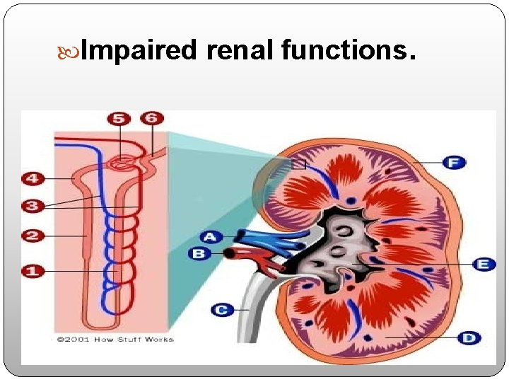  Impaired renal functions. 