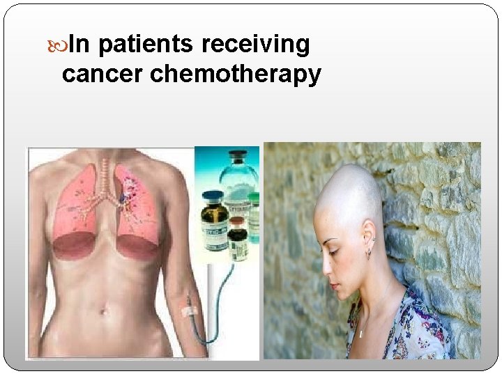  In patients receiving cancer chemotherapy 