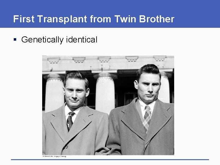 First Transplant from Twin Brother § Genetically identical 