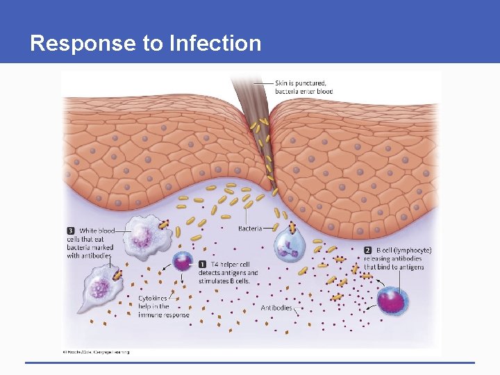 Response to Infection 