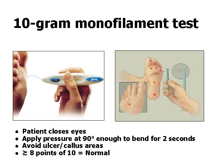 10 -gram monofilament test Patient closes eyes Apply pressure at 90 enough to bend
