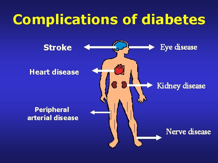 Complications of diabetes Stroke Eye disease Heart disease Kidney disease Peripheral arterial disease Nerve