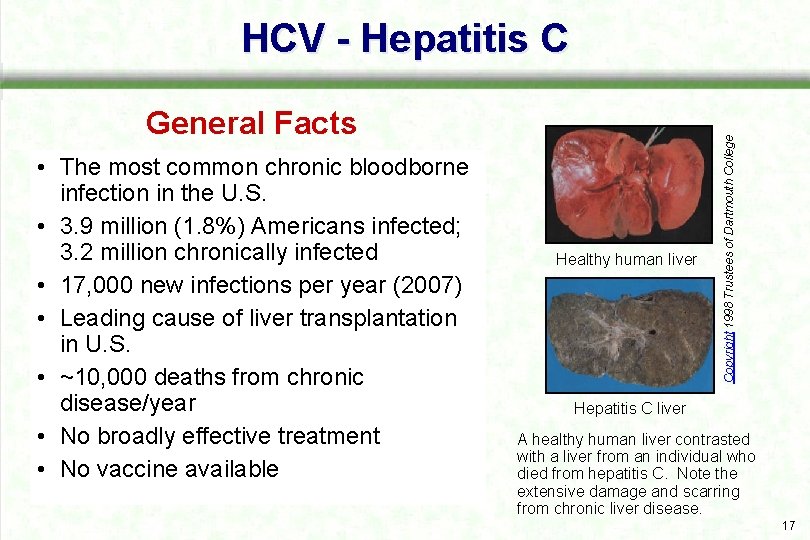 General Facts • The most common chronic bloodborne infection in the U. S. •