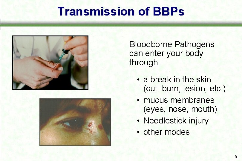 Transmission of BBPs Bloodborne Pathogens can enter your body through • a break in