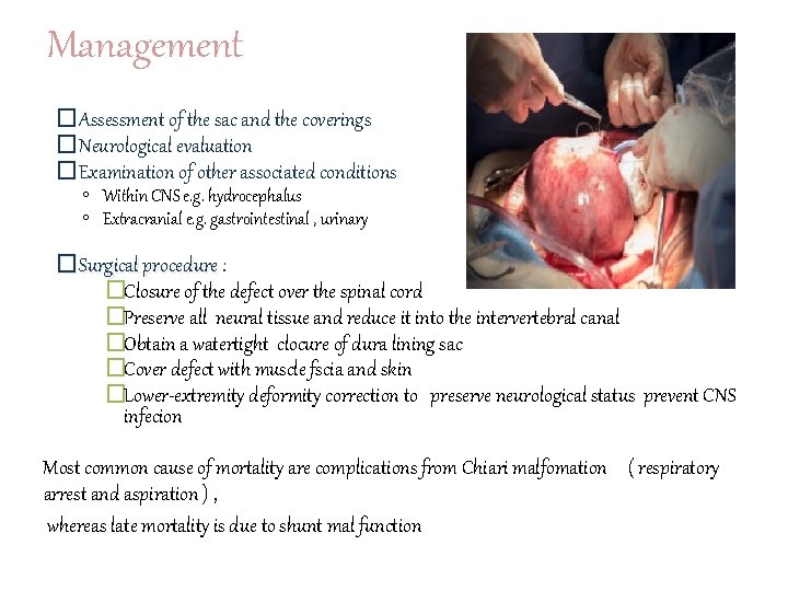 Management �Assessment of the sac and the coverings �Neurological evaluation �Examination of other associated