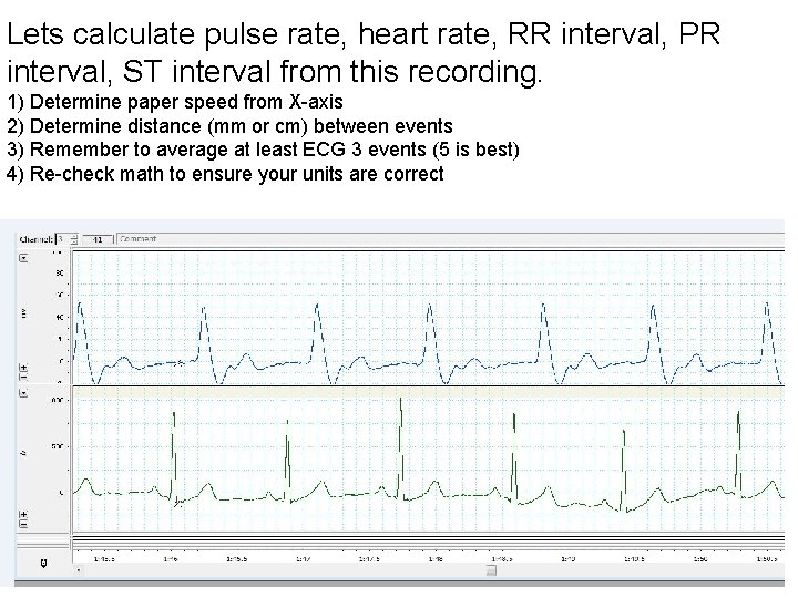 Lets calculate pulse rate, heart rate, RR interval, PR interval, ST interval from this