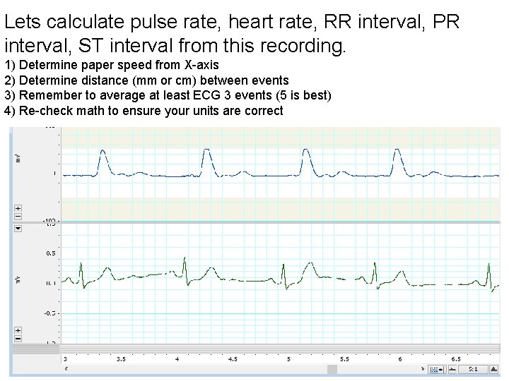 Lets calculate pulse rate, heart rate, RR interval, PR interval, ST interval from this