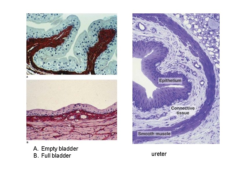 A. Empty bladder B. Full bladder ureter 