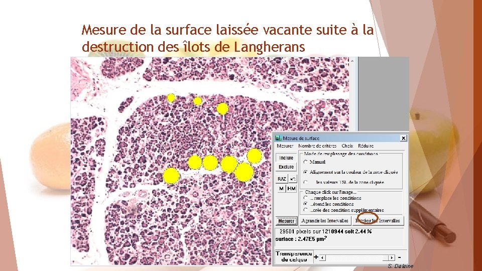 Mesure de la surface laissée vacante suite à la destruction des îlots de Langherans