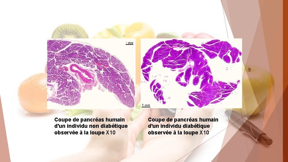 Coupe de pancréas humain d'un individu non diabétique observée à la loupe X 10