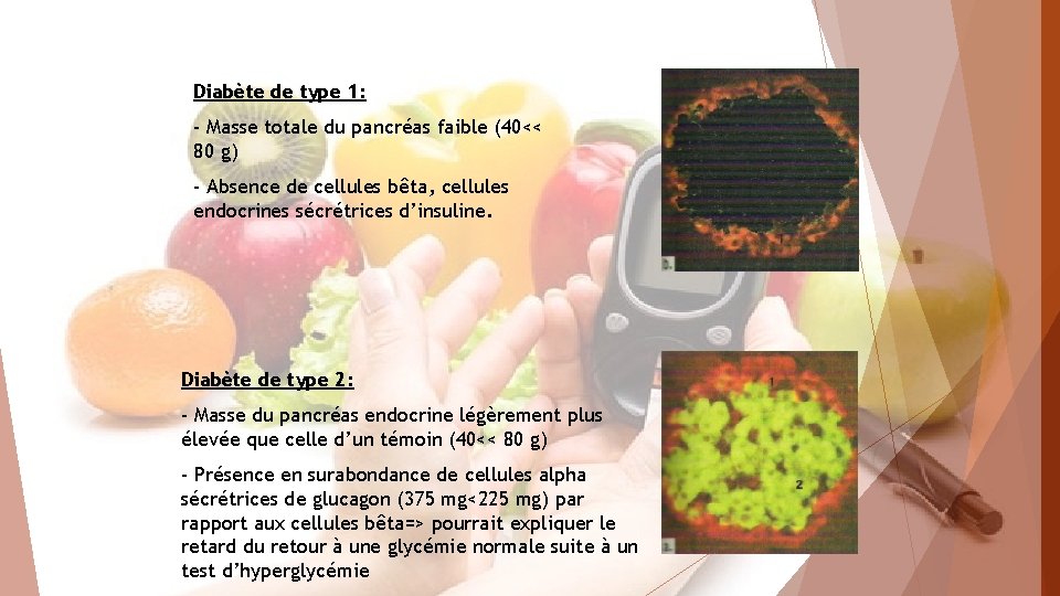 Diabète de type 1: - Masse totale du pancréas faible (40<< 80 g) -
