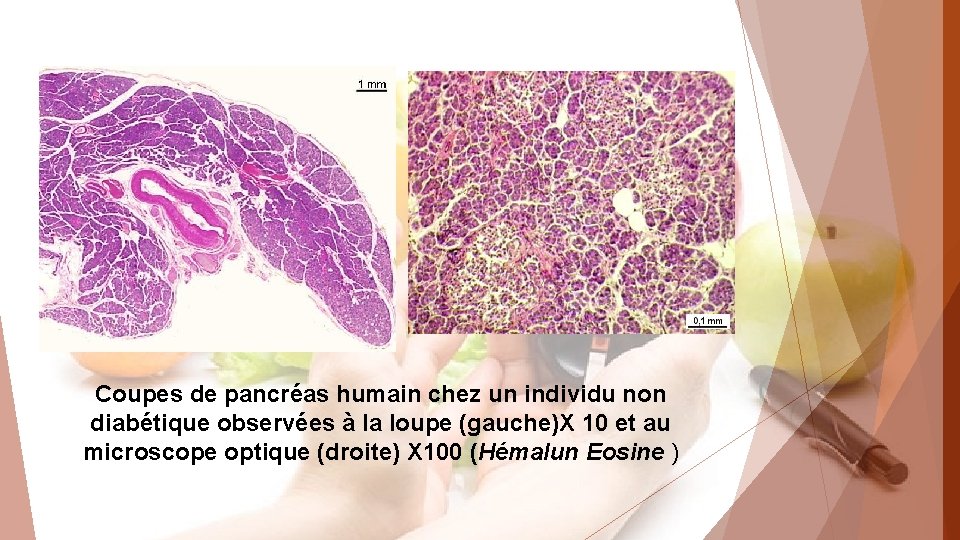 Coupes de pancréas humain chez un individu non diabétique observées à la loupe (gauche)X