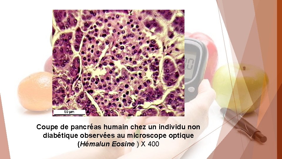 Coupe de pancréas humain chez un individu non diabétique observées au microscope optique (Hémalun
