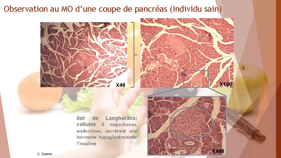 Observation au MO d’une coupe de pancréas (individu sain) X 40 X 100 Ilot