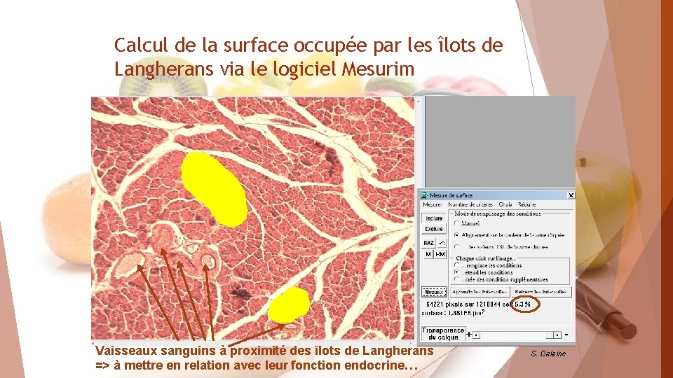 Calcul de la surface occupée par les îlots de Langherans via le logiciel Mesurim