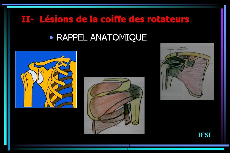 II- Lésions de la coiffe des rotateurs • RAPPEL ANATOMIQUE IFSI 