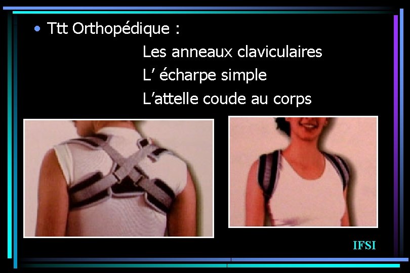  • Ttt Orthopédique : Les anneaux claviculaires L’ écharpe simple L’attelle coude au