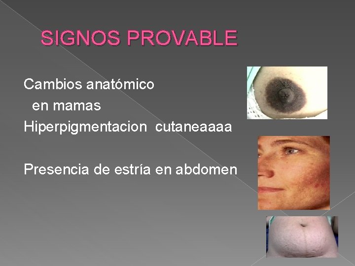 SIGNOS PROVABLE Cambios anatómico en mamas Hiperpigmentacion cutaneaaaa Presencia de estría en abdomen 