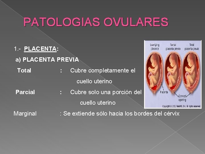 PATOLOGIAS OVULARES 1. - PLACENTA: a) PLACENTA PREVIA Total : Cubre completamente el cuello