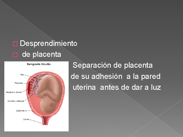 � Desprendimiento � � de placenta Separación de placenta de su adhesión a la