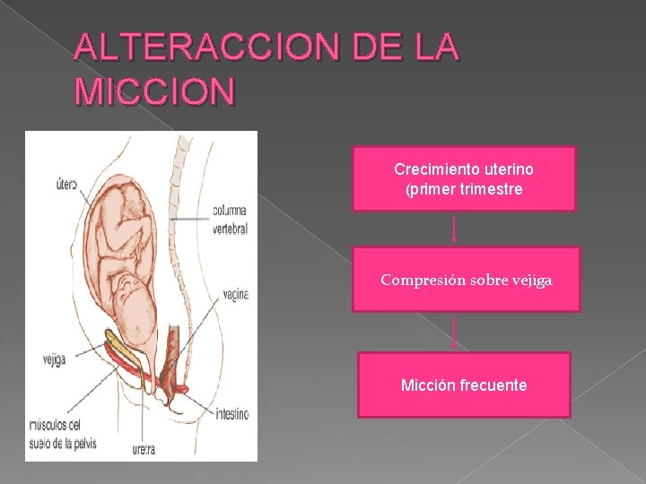 ALTERACCION DE LA MICCION Crecimiento uterino (primer trimestre Compresión sobre vejiga Micción frecuente 