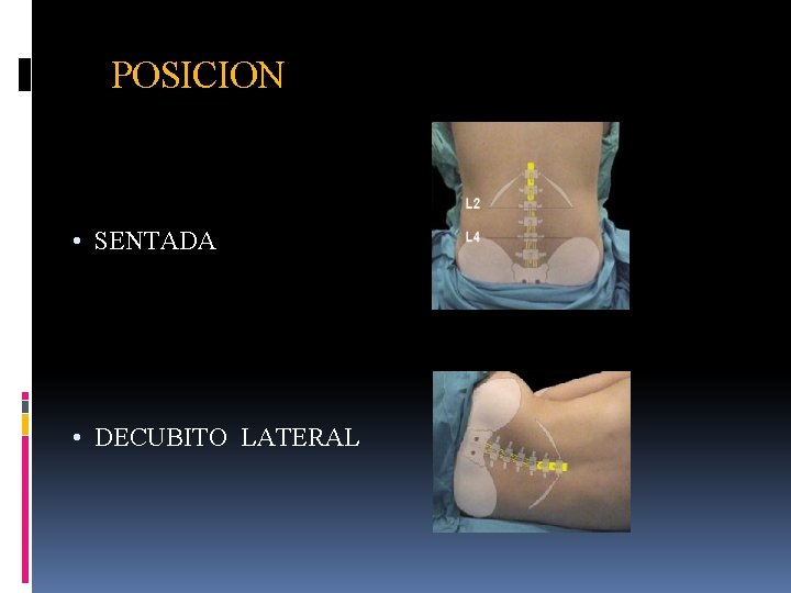 POSICION • SENTADA • DECUBITO LATERAL 