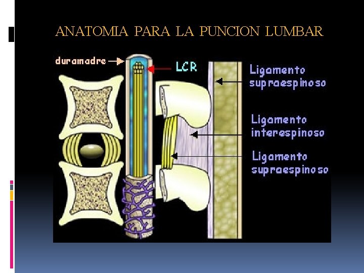 ANATOMIA PARA LA PUNCION LUMBAR 