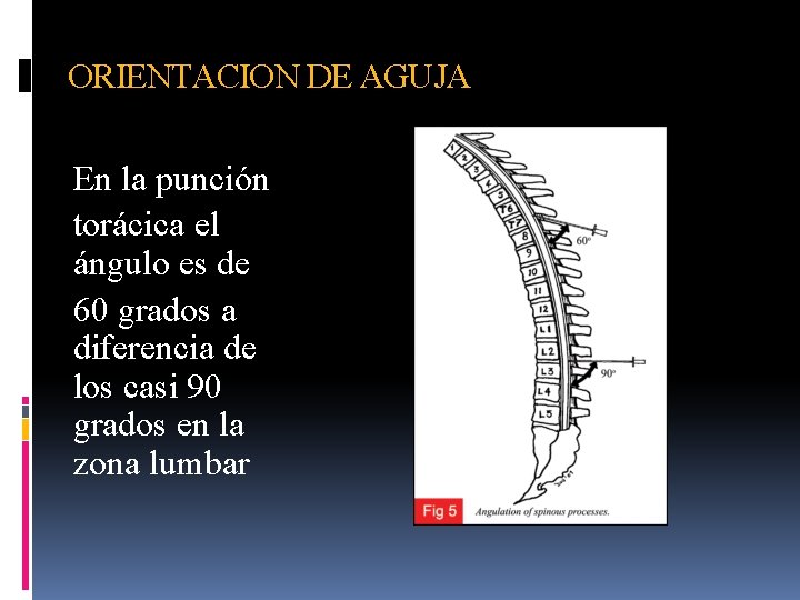 ORIENTACION DE AGUJA En la punción torácica el ángulo es de 60 grados a