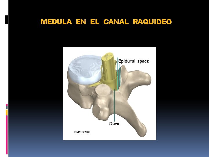 MEDULA EN EL CANAL RAQUIDEO 