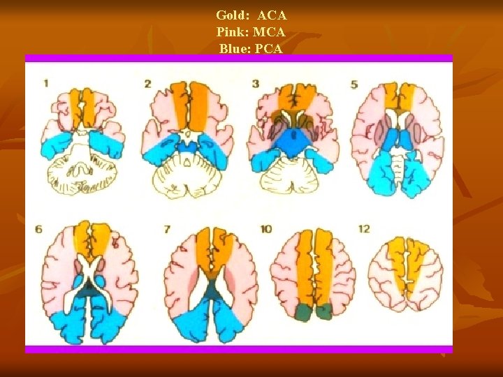 Gold: ACA Pink: MCA Blue: PCA 