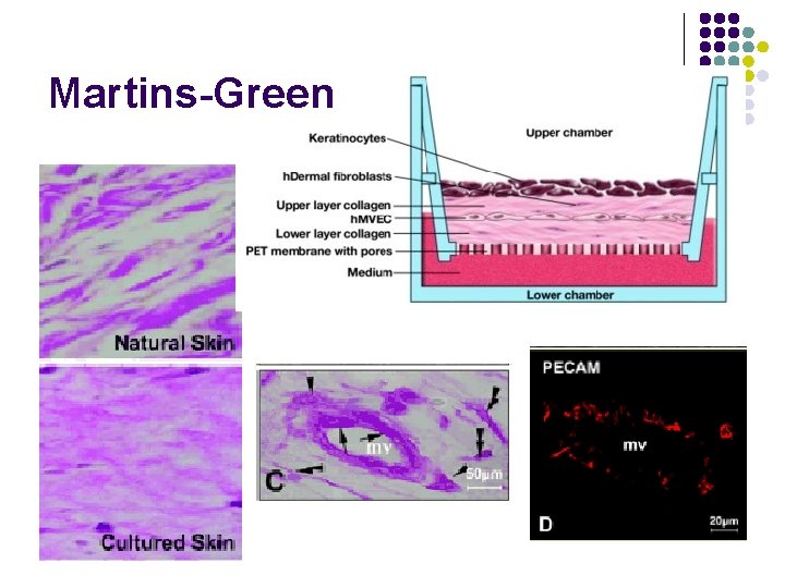 Martins-Green 