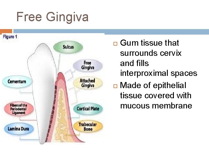 Free Gingiva Gum tissue that surrounds cervix and fills interproximal spaces Made of epithelial