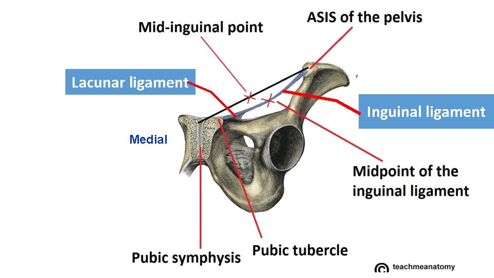 Lacunar ligament Inguinal ligament Medial 