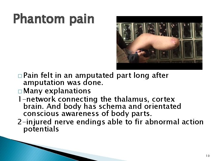 Phantom pain � Pain felt in an amputated part long after amputation was done.