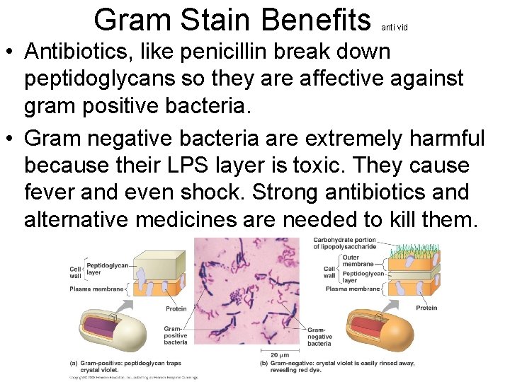 Gram Stain Benefits anti vid • Antibiotics, like penicillin break down peptidoglycans so they