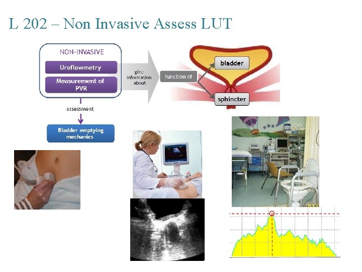 L 202 – Non Invasive Assess LUT 