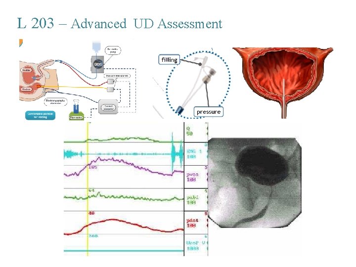 L 203 – Advanced UD Assessment 