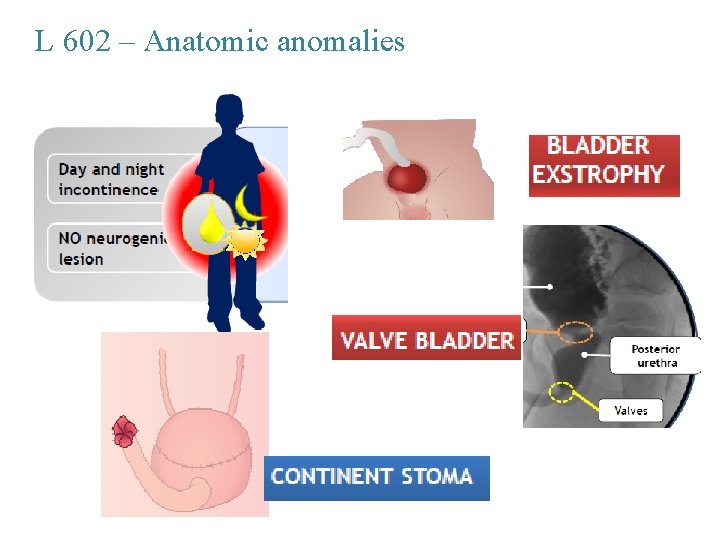 L 602 – Anatomic anomalies 