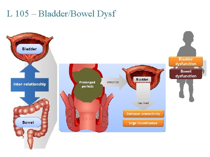 L 105 – Bladder/Bowel Dysf 