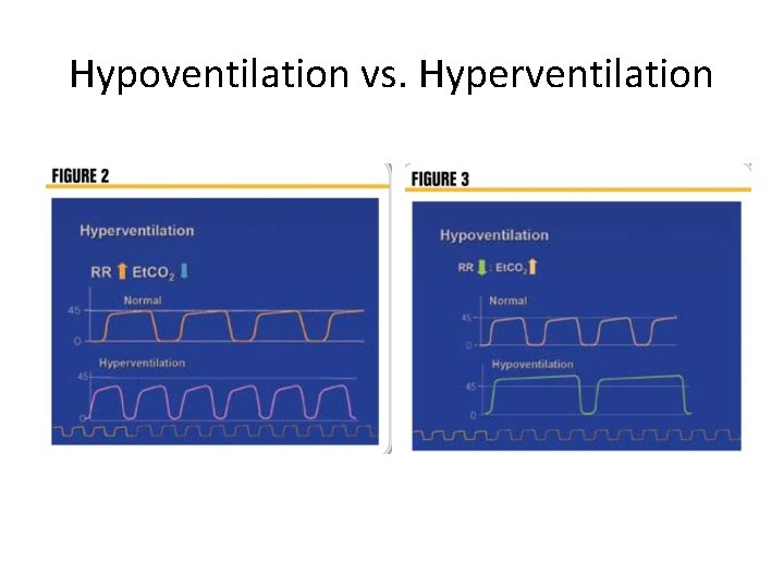 Hypoventilation vs. Hyperventilation 