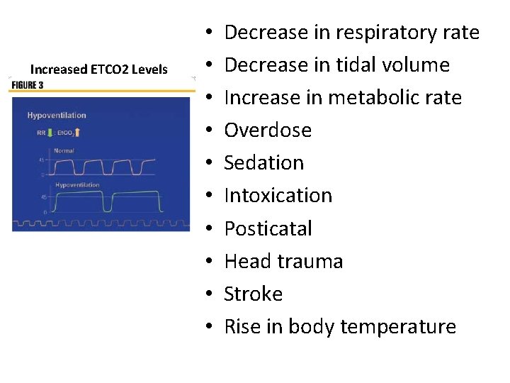 Increased ETCO 2 Levels • • • Decrease in respiratory rate Decrease in tidal