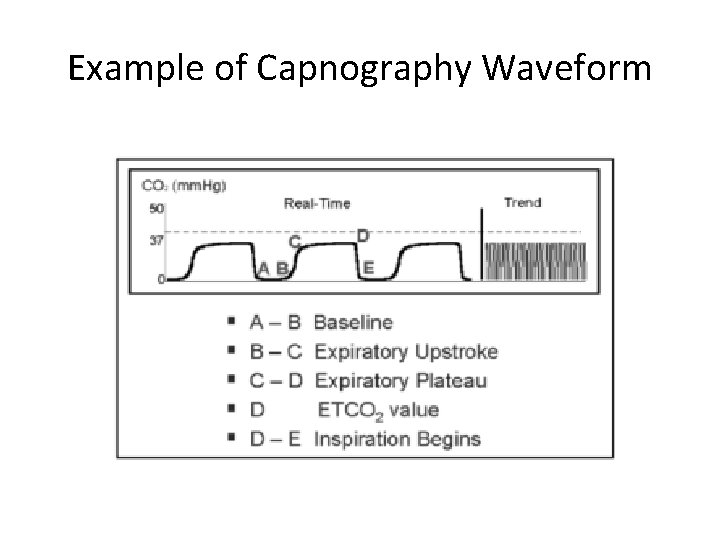 Example of Capnography Waveform 
