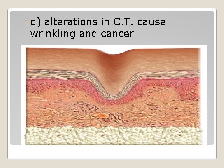 ◦ d) alterations in C. T. cause wrinkling and cancer ◦ d) alterations in C. T. cause wrinkling and cancer