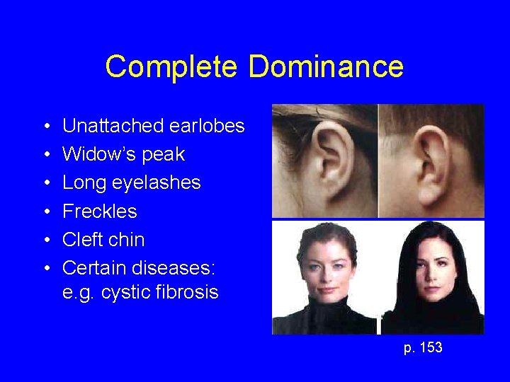 Complete Dominance • • • Unattached earlobes Widow’s peak Long eyelashes Freckles Cleft chin