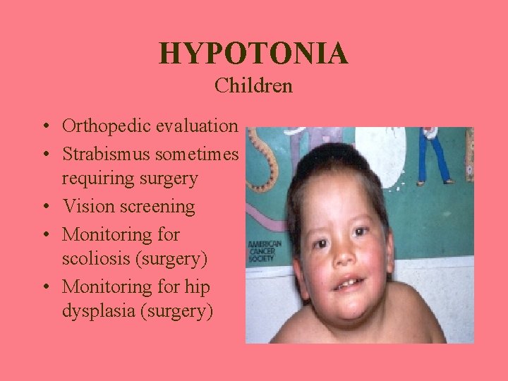 HYPOTONIA Children • Orthopedic evaluation • Strabismus sometimes requiring surgery • Vision screening •