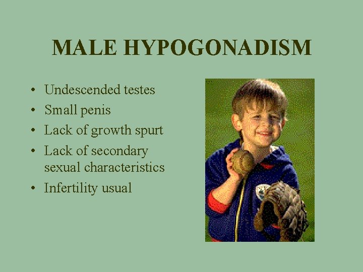 MALE HYPOGONADISM • • Undescended testes Small penis Lack of growth spurt Lack of