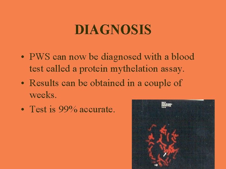DIAGNOSIS • PWS can now be diagnosed with a blood test called a protein